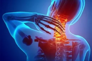 physiotherapy-treatment-for-neck-pain